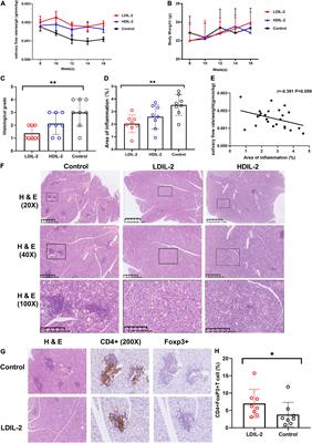 Low Dose Interleukin-2 Ameliorates Sjögren’s Syndrome in a Murine Model